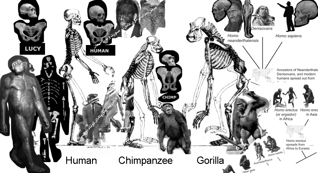 comparison of human and another family branches. Plus bushy hair & short legs syndromes.